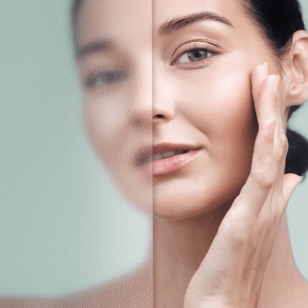 Sublime Peel: trattamento viso ed esfoliazione della pelle